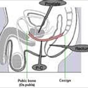 Premature Ejaculation Jokes - How To Last Longer In Bed - Methods To Stop Premature Ejaculation Premature Ejaculation Jokes - How To Last Longer In Bed - Methods To Stop Premature Ejaculation